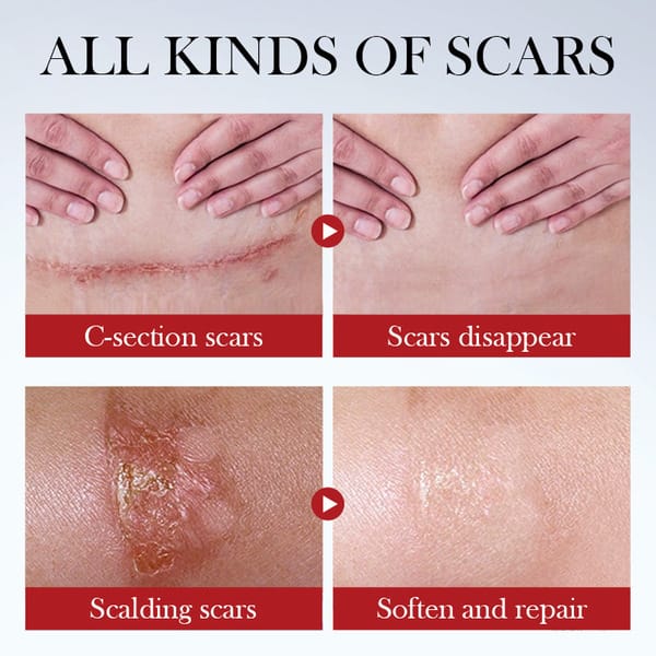 Sadoer Repair Scar Cream